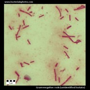 Gram negative bacteria under microscope